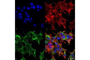 Immunocytochemistry/Immunofluorescence analysis using Mouse Anti-GFAP R416WT Monoclonal Antibody, Clone S206B-9 . (GFAP Antikörper  (AA 411-422) (Atto 390))