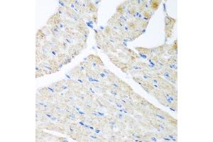 Immunohistochemistry of paraffin-embedded mouse heart using G antibody (ABIN6129967, ABIN6140880, ABIN6140881 and ABIN6223736) at dilution of 1:200 (40x lens). (GABARAPL2 Antikörper  (AA 1-117))