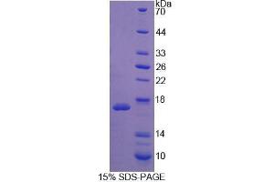 SDS-PAGE analysis of Mouse WISP1 Protein. (WISP1 Protein)