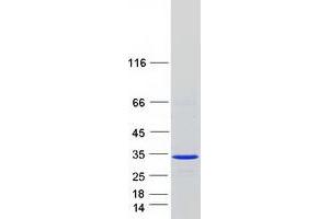 Validation with Western Blot
