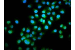 Immunofluorescence staining of Hela cells with ABIN7165653 at 1:100, counter-stained with DAPI. (INTU Antikörper  (AA 6-139))