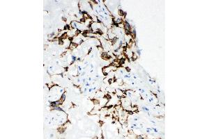 Anti-HYAL1 antibody,  IHC(F) IHC(F): Human Placenta Tissue (HYAL1 Antikörper  (N-Term))