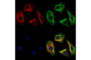 ABIN6261824 and ABIN6273118 staining Hela cells by IF/ICC. (FSTL1 Antikörper  (N-Term))
