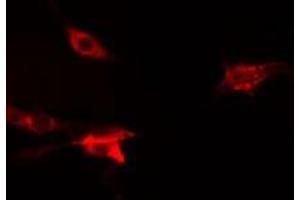 ABIN6275831 staining  Hela cells by IF/ICC. (TRAF2 Antikörper  (C-Term))