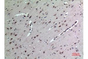 Immunohistochemistry (IHC) analysis of paraffin-embedded Human Brain, antibody was diluted at 1:100. (Midkine Antikörper  (Internal Region))