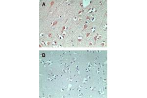 IHC staining of FAM3C using FAM3C polyclonal antibody  in normal human brain at 5 ug/mL (using control rabbit Ig for figure B). (FAM3C Antikörper  (AA 40-80))