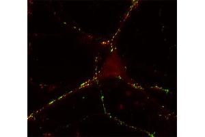 anti-Synaptotagmin III (SYT3) (AA 180-293) antibody