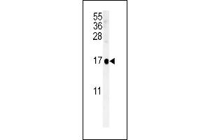 SIKE1 antibody  (C-Term)