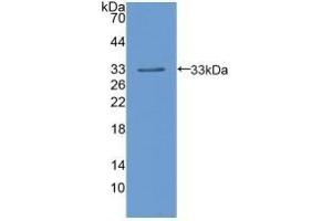 Detection of Recombinant LIPD, Human using Polyclonal Antibody to Lipoprotein lipase (LPL) (Lipoprotein Lipase Antikörper  (AA 55-316))