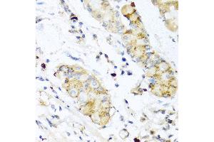 Immunohistochemistry of paraffin-embedded human stomach using IFNL3 antibody at dilution of 1:100 (40x lens). (IL28B Antikörper)