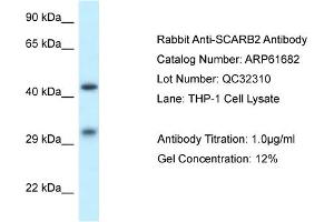Western Blotting (WB) image for anti-Scavenger Receptor Class B, Member 2 (SCARB2) (N-Term) antibody (ABIN2788867)