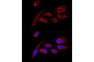 Confocal immunofluorescence analysis of U2OS cells using H Polyclonal Antibody (ABIN6131125, ABIN6137333, ABIN6137334 and ABIN6220624) at dilution of 1:100.