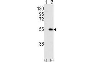Western blot analysis of CAMK1G (arrow) using rabbit polyclonal CAMK1G (Center) Antibody .
