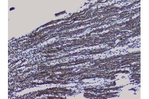 IHC analysis of NRF1 using anti-NRF1 antibody (ABIN6719347). (NRF1 Antikörper  (AA 246-503))