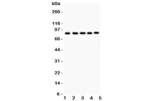 Western blot testing of FOXM1 antibody and Lane 1:  HeLa