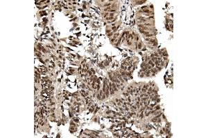 IHC analysis of TIF1 gamma/TRIM33 using anti TIF1 gamma/TRIM33 antibody (ABIN7599621). (TRIM33 Antikörper  (AA 1001-1127))