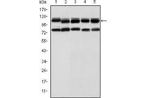Western blot analysis using BMPR2 mouse mAb against Hela (1), A431 (2), NIH/3T3 (3), Cos7 (4) and PC-12 (5) cell lysate. (BMPR2 Antikörper)