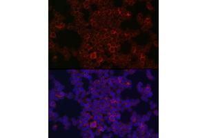 Immunofluorescence analysis of THP-1 cells using CSF1R Rabbit pAb (ABIN3017197, ABIN3017198, ABIN3017199 and ABIN6219993) at dilution of 1:100 (40x lens). (CSF1R Antikörper)