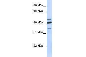 WB Suggested Anti-HYAL1 Antibody Titration:  0. (HYAL1 Antikörper  (N-Term))