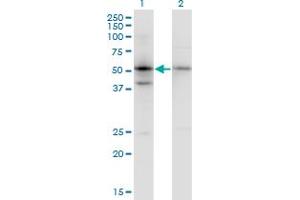 Western Blotting (WB) image for anti-serpin Peptidase Inhibitor, Clade B (Ovalbumin), Member 1 (SERPINB1) (AA 201-300) antibody (ABIN515235)