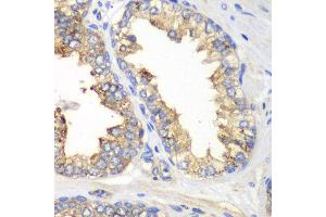 Immunohistochemistry of paraffin-embedded human prostate using KLK10 antibody at dilution of 1:100 (40x lens). (Kallikrein 10 Antikörper)
