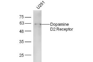 U251 lysates probed with Rabbit Anti-DRD2 Polyclonal Antibody, Unconjugated  at 1:5000 for 90 min at 37˚C. (Dopamine d2 Receptor Antikörper  (AA 201-300))