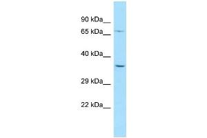 WB Suggested Anti-PALMD Antibody Titration: 1. (PALMD Antikörper  (N-Term))
