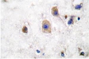 Image no. 2 for anti-Ephrin B3 (EFNB3) antibody (ABIN265403) (Ephrin B3 Antikörper)