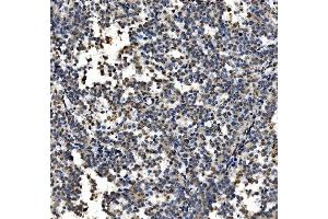 IHC analysis of CDC27 using anti-CDC27 antibody (ABIN7602163). (CDC27 Antikörper  (AA 609-824))