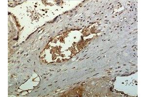 Immunohistochemistry (IHC) image for anti-Chemokine (C-C Motif) Ligand 27 (CCL27) (AA 25-112) antibody (ABIN1983065) (CCL27 Antikörper  (AA 25-112))