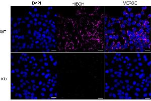 Immunocytochemical staining of HeLa cells using HIBCH antibody (ABIN7797420), 1:1,000), Top panel: wild-type (WT), Bottom panal: HIBCH shRNA knockdown (KD).