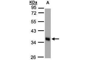 WB Image Sample(30 ug whole cell lysate) A:HeLa S3, 10% SDS PAGE antibody diluted at 1:1000 (PLSCR1 Antikörper)