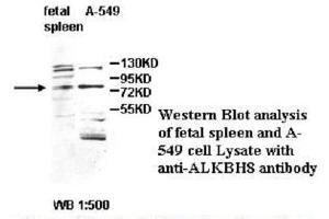 Image no. 1 for anti-Platelet-Derived Growth Factor CC (PDGFCC) antibody (ABIN790864) (Platelet-Derived Growth Factor CC (PDGFCC) Antikörper)