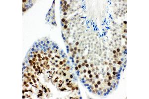Anti- MCAK antibody, IHC(P) IHC(P): Mouse Testis Tissue (KIF2C Antikörper  (AA 531-725))