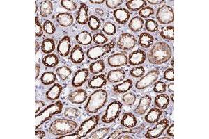Immunohistochemical staining of human kidney with C19orf40 polyclonal antibody  shows strong cytoplasmic positivity in renal tubules. (C19orf24 Antikörper)