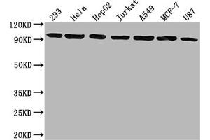 Western Blot Positive WB detected in: 293 whole cell lysate, Hela whole cell lysate, HepG2 whole cell lysate, Jurkat whole cell lysate, A549 whole cell lysate, MCF-7 whole cell lysate, U87 whole cell lysate All lanes: NR3C1 antibody at 1:1500 Secondary Goat polyclonal to rabbit IgG at 1/50000 dilution Predicted band size: 86, 83, 82, 77, 76, 65, 61, 52, 51, 50 kDa Observed band size: 95 kDa (Rekombinanter Glucocorticoid Receptor Antikörper)