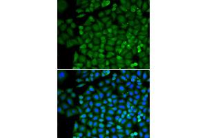 Immunofluorescence analysis of HeLa cells using SELENBP1 antibody (ABIN5970564). (SELENBP1 Antikörper)