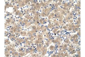 PPIB antibody was used for immunohistochemistry at a concentration of 4-8 ug/ml to stain Hepatocytes (arrows) in Human Liver. (PPIB Antikörper)