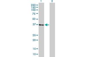 Western Blot analysis of LZTFL1 expression in transfected 293T cell line by LZTFL1 MaxPab polyclonal antibody. (LZTFL1 Antikörper  (AA 1-299))