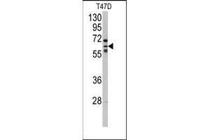 Image no. 1 for anti-Cytochrome P450, Family 2, Subfamily C, Polypeptide 8 (CYP2C8) (N-Term) antibody (ABIN360416) (CYP2C8 Antikörper  (N-Term))