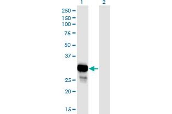 PNP anticorps  (AA 1-289)