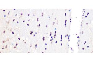 Immunohistochemistry of paraffin-embedded Rat brain using PCIF1 Polyclonal Antibody at dilution of 1:100 (40x lens). (PCIF1 Antikörper)