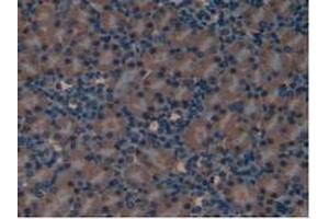 Detection of LIFR in Mouse Kidney Tissue using Polyclonal Antibody to Leukemia Inhibitory Factor Receptor (LIFR) (LIFR Antikörper  (AA 381-485))