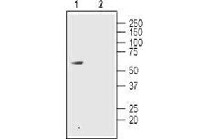 Western blot analysis of rat colon lysate: - 1. (GLP2R Antikörper  (1st Extracellular Loop))