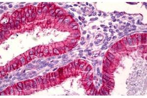 Anti-BAX antibody IHC staining of human uterus, endometrium.