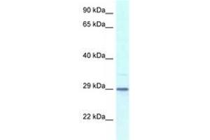 Image no. 1 for anti-Kv Channel Interacting Protein 3, Calsenilin (KCNIP3) (AA 30-79) antibody (ABIN6747422) (DREAM Antikörper  (AA 30-79))