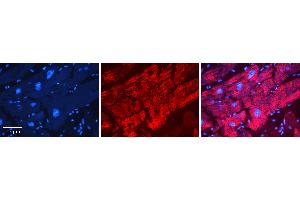 Rabbit Anti-AGPAT2 Antibody Catalog Number: ARP44636_P050 Formalin Fixed Paraffin Embedded Tissue: Human heart Tissue Observed Staining: Cytoplasmic Primary Antibody Concentration: N/A Other Working Concentrations: 1:600 Secondary Antibody: Donkey anti-Rabbit-Cy3 Secondary Antibody Concentration: 1:200 Magnification: 20X Exposure Time: 0.