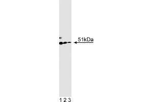 Western Blotting (WB) image for anti-HNF1 Homeobox B (HNF1B) (AA 1-101) antibody (ABIN968855) (HNF1B Antikörper  (AA 1-101))