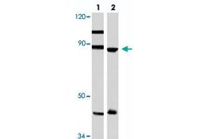 Western blot analysis of Hela (lane 1) and A-549 (lane 2) cell lysate with TPX2 polyclonal antibody . (TPX2 Antikörper)