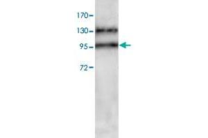 Western blot analysis of HeLa cell lysate with ADAM17 polyclonal antibody  at 1 : 200 dilution. (ADAM17 Antikörper  (C-Term))